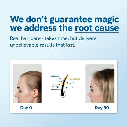 Be Bodywise Hair Growth & Anti-Hair Fall Roll-On Serum | With Rosemary, Aminexil, Redensyl & Anagain | Easy Scalp Care | Paraben & Sulphate Free | Lightweight Formula