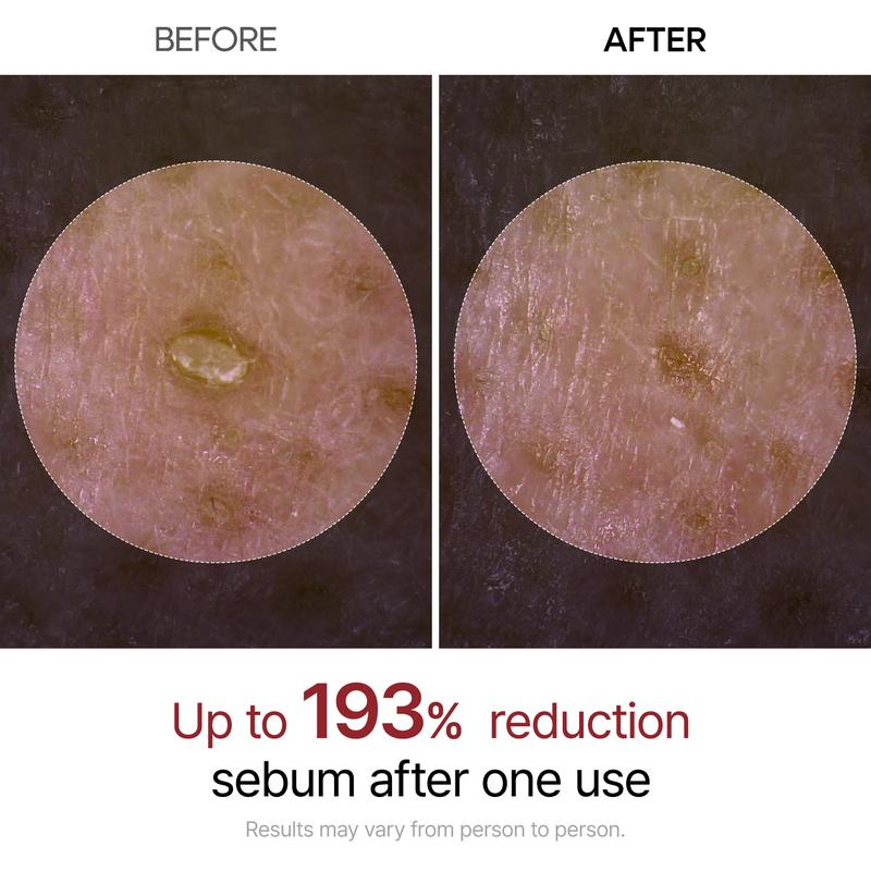 [Dr.Melaxin Official] Peel Shot Glow Rice Peeling Ampoule, Soft Exfoliating Face & Body Dead cell, Blackheads Remover for All Skin Types, 80ml Skincare Comfort ampoule