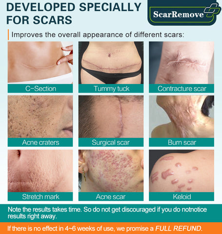 Scar Repair Cream for Men &amp; Women | Fade Scars &amp; Firm Skin